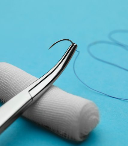Laparoscopy